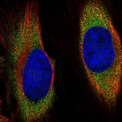 Invitrogen RGR Polyclonal Antibody 100 &mu;L; Unconjugated:Antibodies,