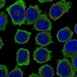 Invitrogen ITK Polyclonal Antibody 100 &mu;L; Unconjugated:Antibodies,