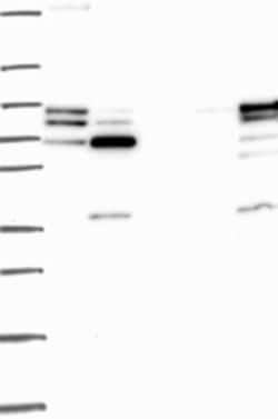 Invitrogen GRK2 Polyclonal Antibody 100 &mu;L; Unconjugated:Antibodies,