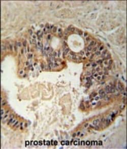Invitrogen DYRK1A Polyclonal Antibody 400 &mu;L; Unconjugated:Antibodies,