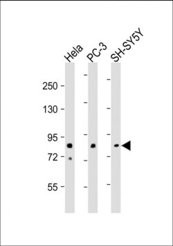 Invitrogen DYRK1A Polyclonal Antibody 400 &mu;L; Unconjugated:Antibodies,