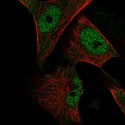 Invitrogen CREB3L1 Polyclonal Antibody 100 &mu;L; Unconjugated:Antibodies,