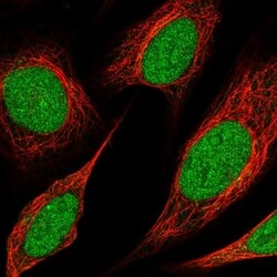 Invitrogen KMT2C Polyclonal Antibody 100 &mu;L; Unconjugated:Antibodies,