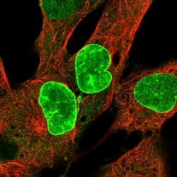 Invitrogen CENPF Polyclonal Antibody 100 &mu;L; Unconjugated:Antibodies,