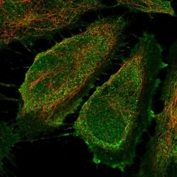 Invitrogen CD83 Polyclonal Antibody 100 &mu;L; Unconjugated:Antibodies,
