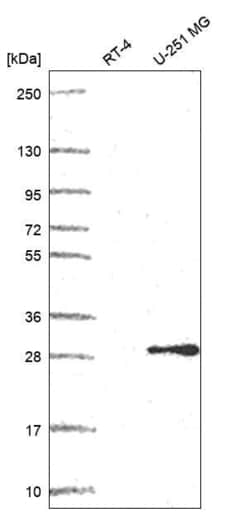 Invitrogen POP4 Polyclonal Antibody 100 &mu;L; Unconjugated:Antibodies,