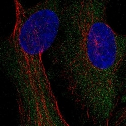 Invitrogen CAD Polyclonal Antibody 100 &mu;L | Buy Online | Invitrogen&trade; | Fisher Scientific