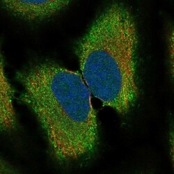 Invitrogen RAB41 Polyclonal Antibody 100 &mu;L; Unconjugated:Antibodies,
