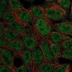 Invitrogen ATOH1 Polyclonal Antibody 100 &mu;L; Unconjugated:Antibodies,