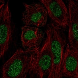 Invitrogen FN3KRP Polyclonal Antibody 100 &mu;L; Unconjugated:Antibodies,