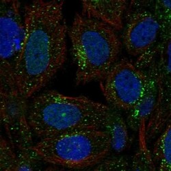 Invitrogen SEC23A Polyclonal Antibody 100 &mu;L; Unconjugated:Antibodies,