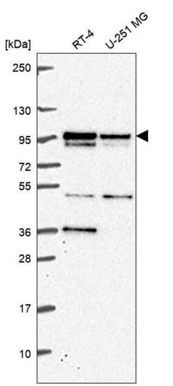 Invitrogen KIF3B Polyclonal Antibody 100 &mu;L; Unconjugated:Antibodies,