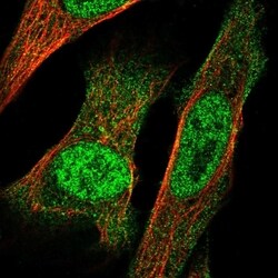 Invitrogen IRX3 Polyclonal Antibody 100 &mu;L; Unconjugated:Antibodies,