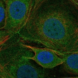 Invitrogen CACNA1I Polyclonal Antibody 100 &mu;L; Unconjugated:Antibodies,