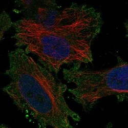 Invitrogen KCNV1 Polyclonal Antibody 100 &mu;L; Unconjugated:Antibodies,