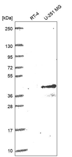 Invitrogen CD1c Polyclonal Antibody 100 &mu;L; Unconjugated:Antibodies,