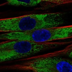 Invitrogen COL1A2 Polyclonal Antibody 100 &mu;L | Buy Online | Invitrogen&trade; | Fisher Scientific
