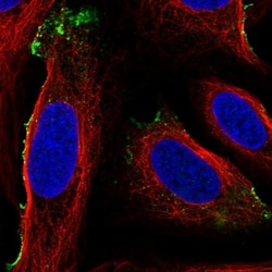 Invitrogen MSP Polyclonal Antibody 100 &mu;L; Unconjugated:Antibodies,
