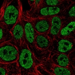 Invitrogen JNK3 Polyclonal Antibody 100 &mu;L; Unconjugated:Antibodies,