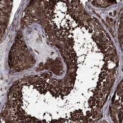 Invitrogen EIF2B4 Polyclonal Antibody 100 &mu;L; Unconjugated:Antibodies,
