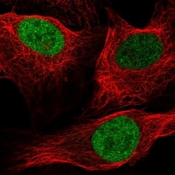 Invitrogen ID1 Polyclonal Antibody 100 &mu;L; Unconjugated:Antibodies,
