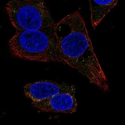 Invitrogen SERPINA4 Polyclonal Antibody 100 &mu;L; Unconjugated:Antibodies,