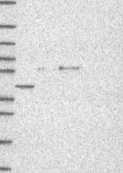 Invitrogen SERPINA4 Polyclonal Antibody 100 &mu;L; Unconjugated:Antibodies,