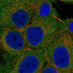 Invitrogen ACK1 Polyclonal Antibody 100 &mu;L; Unconjugated:Antibodies,