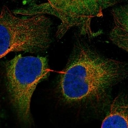 Invitrogen SLC38A2 Polyclonal Antibody 100 &mu;L; Unconjugated:Antibodies,