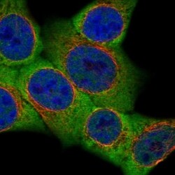 Invitrogen DLG7 Polyclonal Antibody 100 &mu;L; Unconjugated:Antibodies,