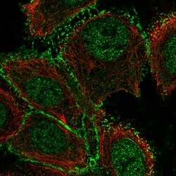 Invitrogen GALNT12 Polyclonal Antibody 100 &mu;L; Unconjugated:Antibodies,