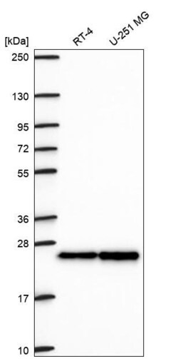 Invitrogen HP1 beta Polyclonal Antibody 100 &mu;L; Unconjugated:Antibodies,