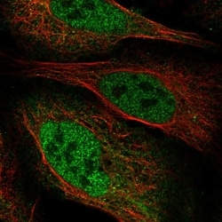 Invitrogen ZBTB8B Polyclonal Antibody 100 &mu;L; Unconjugated:Antibodies,