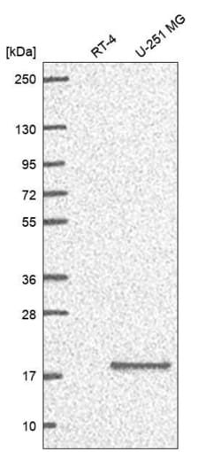 Invitrogen RPS23 Polyclonal Antibody 100 &mu;L; Unconjugated:Antibodies,