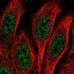 Invitrogen EPC1 Polyclonal Antibody 100 &mu;L; Unconjugated:Antibodies,