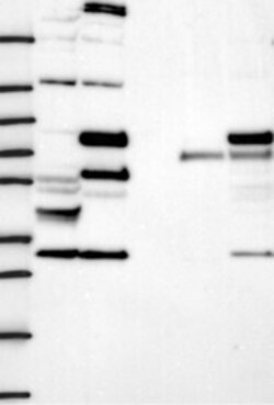 Invitrogen CEP63 Polyclonal Antibody 100 &mu;L; Unconjugated:Antibodies,
