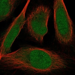 Invitrogen ZMIZ2 Polyclonal Antibody 100 &mu;L; Unconjugated:Antibodies,