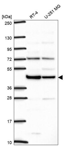 Invitrogen ILF2 Polyclonal Antibody 100 &mu;L; Unconjugated:Antibodies,