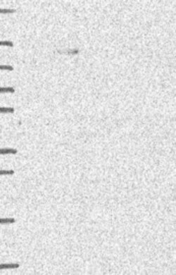 Invitrogen PHF17 Polyclonal Antibody 100 &mu;L | Buy Online | Invitrogen&trade; | Fisher Scientific