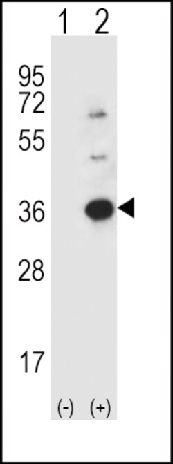 Invitrogen Caspase 3 Polyclonal Antibody 400 &mu;L; Unconjugated:Anticuerpos