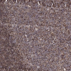 Invitrogen RIG-I Polyclonal Antibody 100 &mu;L; Unconjugated:Antibodies,