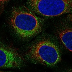 Invitrogen TEX264 Polyclonal Antibody 100 &mu;L; Unconjugated:Antibodies,