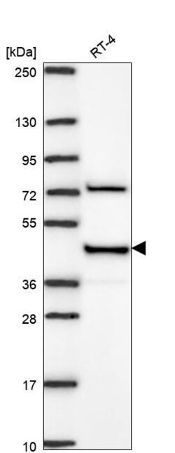 Invitrogen RAP Polyclonal Antibody 100 &mu;L | Buy Online | Invitrogen&trade; | Fisher Scientific
