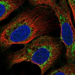 Invitrogen C17orf80 Polyclonal Antibody 100 &mu;L; Unconjugated:Antibodies,