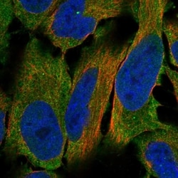 Invitrogen LHR Polyclonal Antibody 100 &mu;L | Buy Online | Invitrogen&trade; | Fisher Scientific