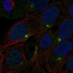 Invitrogen C1orf146 Polyclonal Antibody 100 &mu;L; Unconjugated:Antibodies,