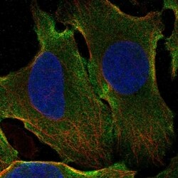 Invitrogen GPATCH1 Polyclonal Antibody 100 &mu;L; Unconjugated:Antibodies,