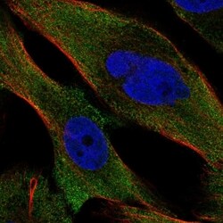 Invitrogen PPP3CC Polyclonal Antibody 100 &mu;L; Unconjugated:Antibodies,