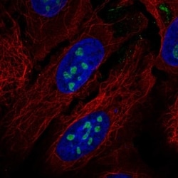 Invitrogen RORA Polyclonal Antibody 100 &mu;L | Buy Online | Invitrogen&trade; | Fisher Scientific