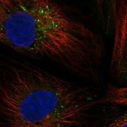 Invitrogen MATN3 Polyclonal Antibody 100 &mu;L; Unconjugated:Antibodies,